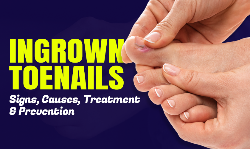 Ingrown Toenails Signs Causes Treatment Prevention Ingrown